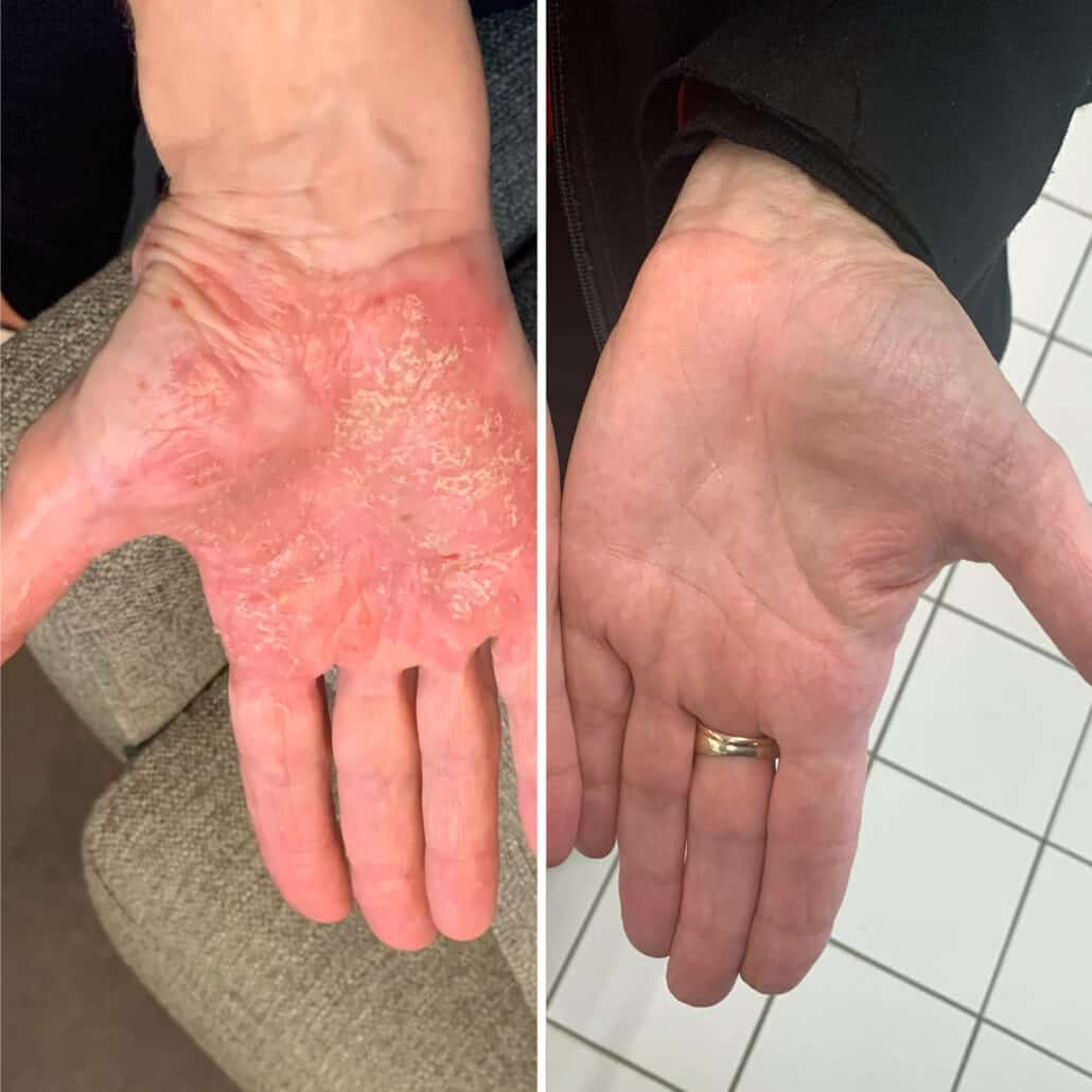 ECZÉMA 3 MOIS DE ROUTINE BIO EFFICACE Gaiia Savon à froid